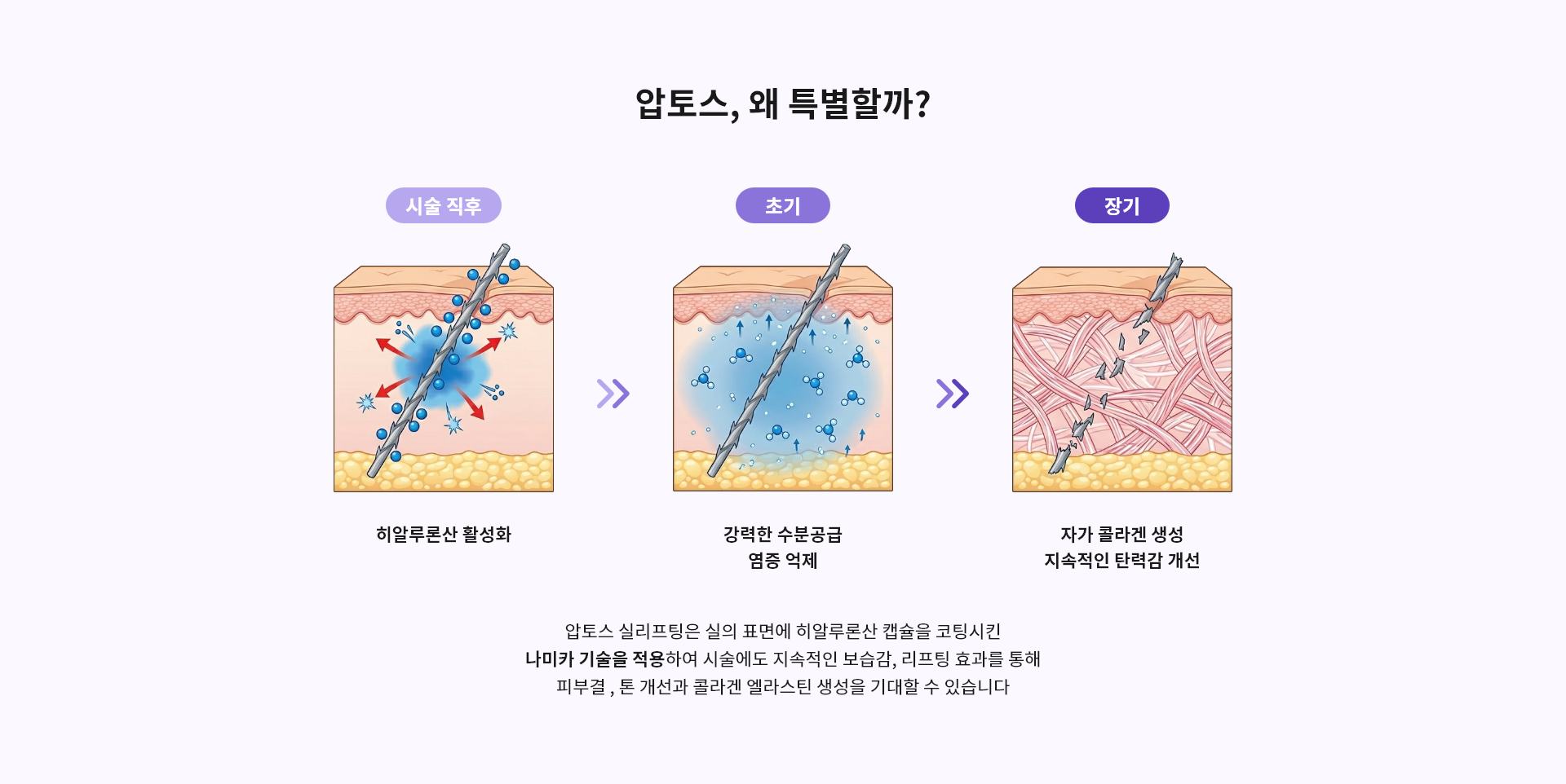 압토스, 왜 특별할까?